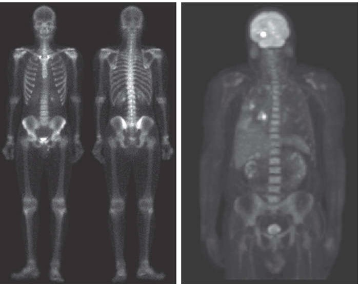Aplicações médicas utilizando raios Gamma [@gonzalez].